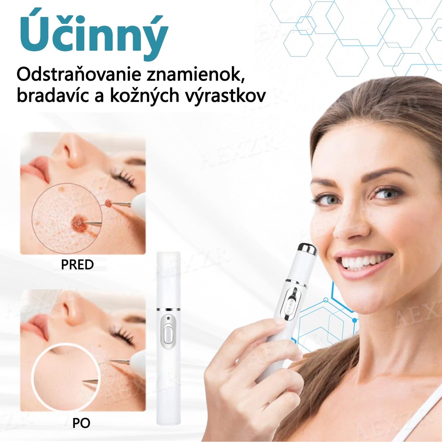 Bikenda® Neinvazívne laserové pero na odstránenie znamienok a bradavíc🔦