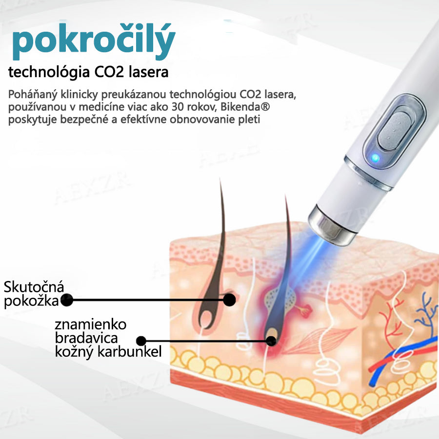 Bikenda® Neinvazívne laserové pero na odstránenie znamienok a bradavíc🔦